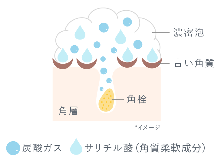 解説図